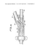 DIALYSIS CATHETER diagram and image