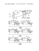 TRANSSEPTAL NEEDLE APPARATUS diagram and image