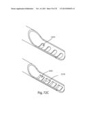 RECIPROCATING SURGICAL INSTRUMENT diagram and image