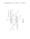 METHOD AND DEVICE FOR INSERTING AN INTRAOCULAR LENS diagram and image