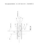 METHOD AND DEVICE FOR INSERTING AN INTRAOCULAR LENS diagram and image