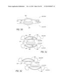 METHOD AND DEVICE FOR INSERTING AN INTRAOCULAR LENS diagram and image