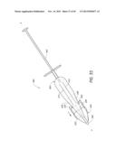 METHOD AND DEVICE FOR INSERTING AN INTRAOCULAR LENS diagram and image