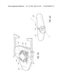 METHOD AND DEVICE FOR INSERTING AN INTRAOCULAR LENS diagram and image