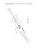 METHOD AND DEVICE FOR INSERTING AN INTRAOCULAR LENS diagram and image