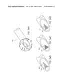 METHOD AND DEVICE FOR INSERTING AN INTRAOCULAR LENS diagram and image