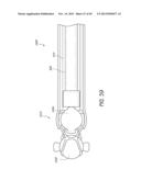 METHOD AND DEVICE FOR INSERTING AN INTRAOCULAR LENS diagram and image