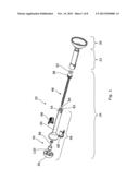 OBSTETRIC VACUUM EXTRACTOR diagram and image