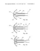 OBSTETRIC VACUUM EXTRACTOR diagram and image