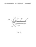 OBSTETRIC VACUUM EXTRACTOR diagram and image