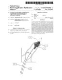 SYSTEMS AND METHODS FOR REMOVING UNDESIRABLE MATERIAL WITHIN A CIRCULATON     SYSTEM UTILIZING A BALLOON CATHETER diagram and image