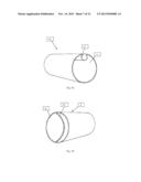 SYSTEMS AND METHODS FOR REMOVING UNDESIRABLE MATERIAL WITHIN A CIRCULATON     SYSTEM UTILIZING A BALLOON CATHETER diagram and image