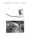 APPLICATOR INSTRUMENTS FOR DISPENSING SURGICAL FASTENERS DURING OPEN     REPAIR PROCEDURES diagram and image