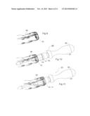 DEVICE AND METHOD FOR ANASTOMOSIS diagram and image