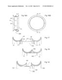 DEVICE AND METHOD FOR ANASTOMOSIS diagram and image