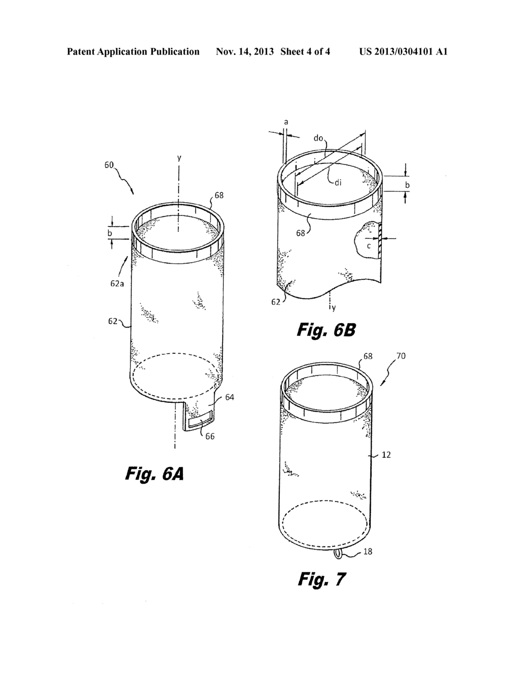 ANASTOMOSIS SHEATH AND METHOD OF USE - diagram, schematic, and image 05