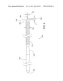 SYSTEMS AND APPARATUS FOR TREATING BLOOD VESSELS AND RELATED METHODS diagram and image