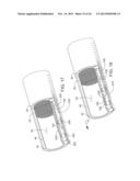 SYSTEMS AND APPARATUS FOR TREATING BLOOD VESSELS AND RELATED METHODS diagram and image