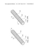 SYSTEMS AND APPARATUS FOR TREATING BLOOD VESSELS AND RELATED METHODS diagram and image