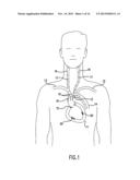 ANTI-EMBOLIC DEVICE AND METHOD diagram and image