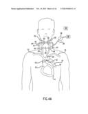 ANTI-EMBOLIC DEVICE AND METHOD diagram and image