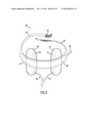 ANTI-EMBOLIC DEVICE AND METHOD diagram and image