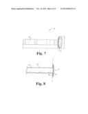 Implantable Graft to Close a Fistula diagram and image