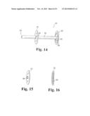 Implantable Graft to Close a Fistula diagram and image