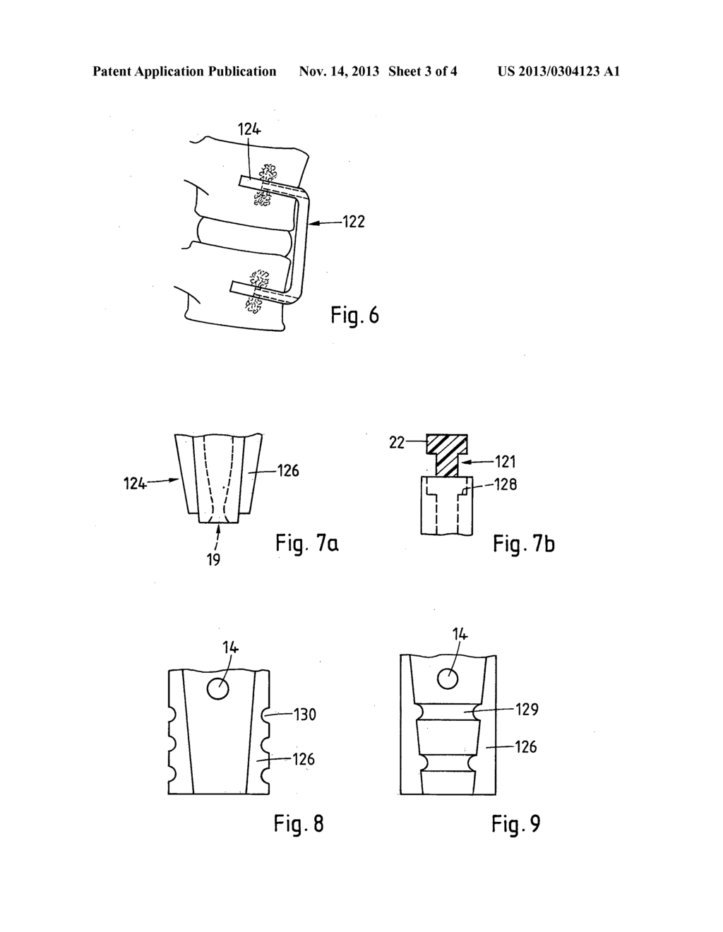 ANTERIOR CERVICAL PLATE - diagram, schematic, and image 04