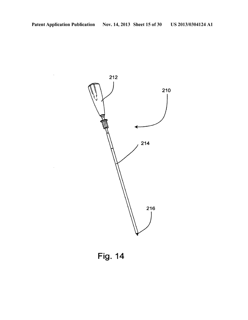 SYSTEM AND METHOD FOR VERTEBRAL BODY PLATING - diagram, schematic, and image 16