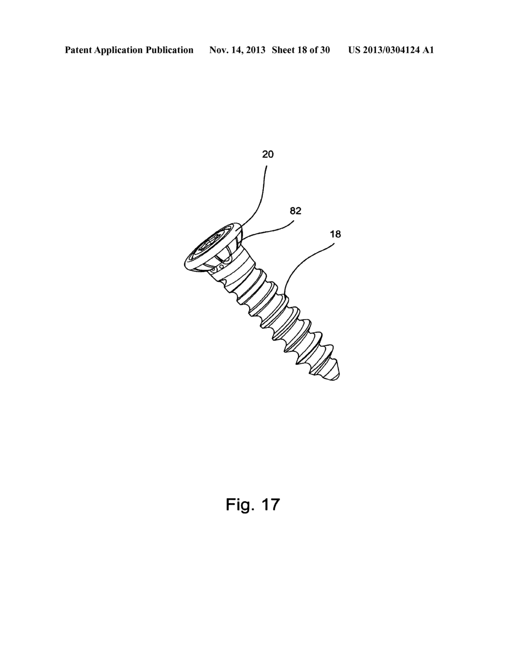 SYSTEM AND METHOD FOR VERTEBRAL BODY PLATING - diagram, schematic, and image 19