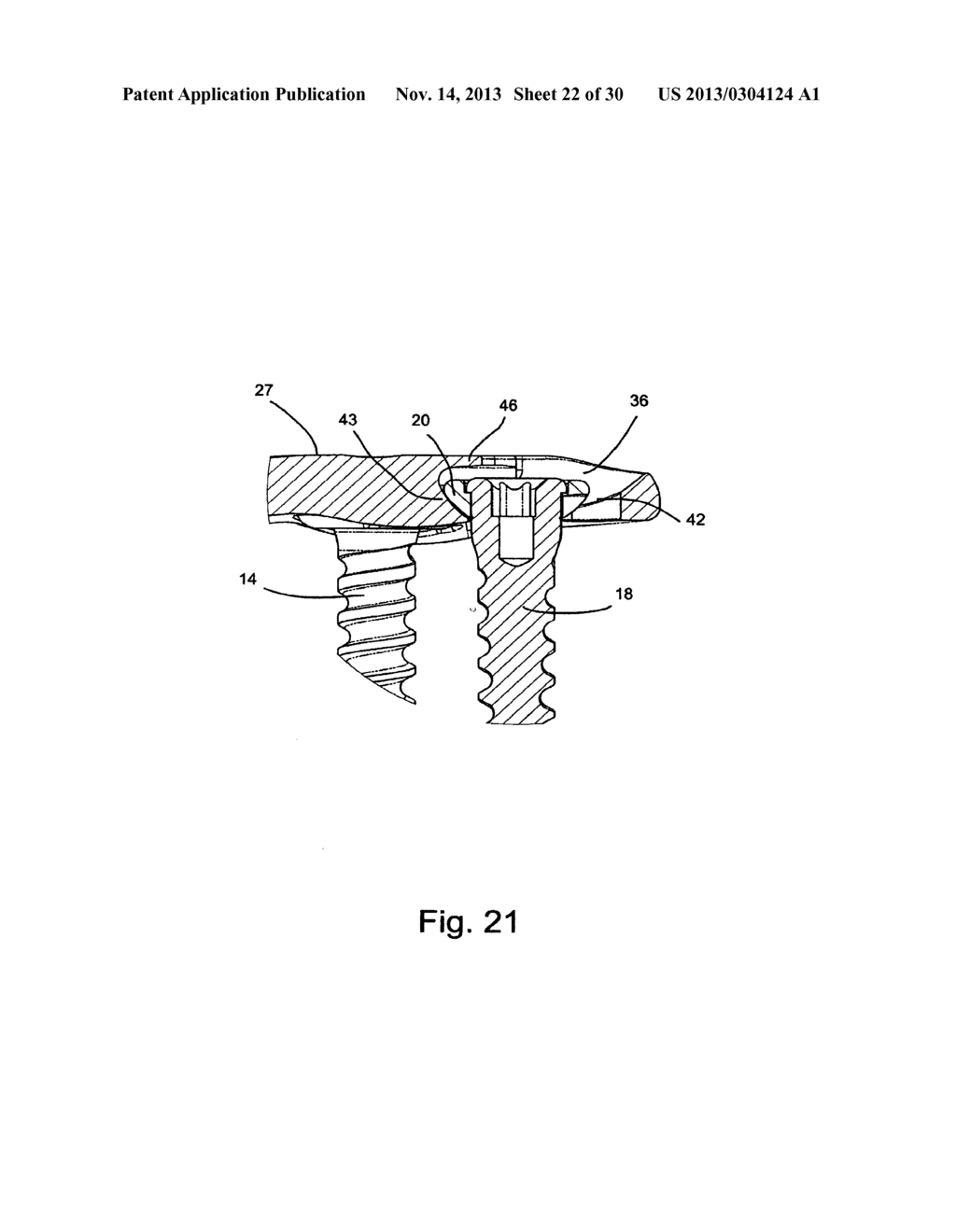 SYSTEM AND METHOD FOR VERTEBRAL BODY PLATING - diagram, schematic, and image 23