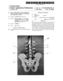 ILIAC CONNECTOR, CONNECTOR HEAD, SPINAL FIXATION SYSTEM AND METHOD OF     STABILIZING A SPINE diagram and image