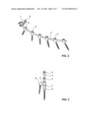 ILIAC CONNECTOR, CONNECTOR HEAD, SPINAL FIXATION SYSTEM AND METHOD OF     STABILIZING A SPINE diagram and image