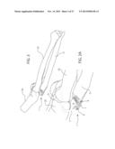 INTERNAL JOINT STABILIZER DEVICE, SYSTEM AND METHOD OF USE diagram and image