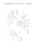 INTERNAL JOINT STABILIZER DEVICE, SYSTEM AND METHOD OF USE diagram and image