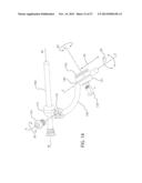 INTERNAL JOINT STABILIZER DEVICE, SYSTEM AND METHOD OF USE diagram and image