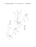 INTERNAL JOINT STABILIZER DEVICE, SYSTEM AND METHOD OF USE diagram and image