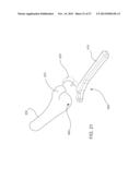 INTERNAL JOINT STABILIZER DEVICE, SYSTEM AND METHOD OF USE diagram and image