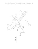 INTERNAL JOINT STABILIZER DEVICE, SYSTEM AND METHOD OF USE diagram and image