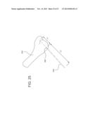 INTERNAL JOINT STABILIZER DEVICE, SYSTEM AND METHOD OF USE diagram and image