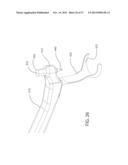 INTERNAL JOINT STABILIZER DEVICE, SYSTEM AND METHOD OF USE diagram and image