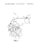 MULTIPOLAR CONDUCTOR FOR AN IMPLANTABLE MEDICAL DEVICE diagram and image