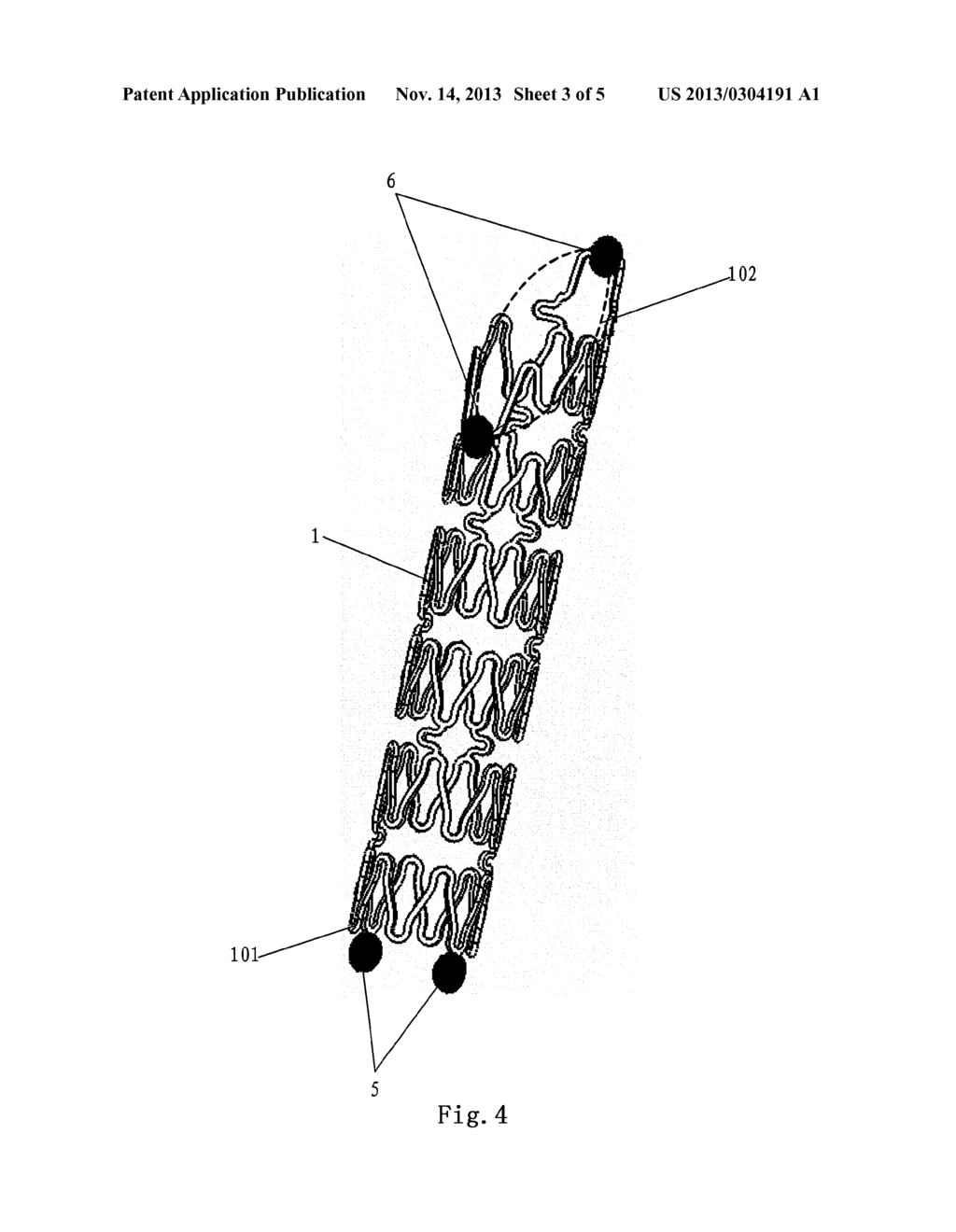 STENT FOR A BIFURCATED VESSEL - diagram, schematic, and image 04