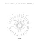 ACCOMMODATING INTRAOCULAR LENS WITH A COMPRESSIBLE INNER STRUCTURE diagram and image