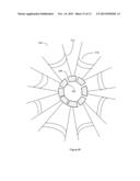 ACCOMMODATING INTRAOCULAR LENS WITH A COMPRESSIBLE INNER STRUCTURE diagram and image