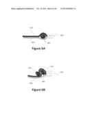 Accommodative-Disaccommodative intraocular Lens diagram and image