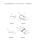 Accommodative-Disaccommodative intraocular Lens diagram and image