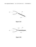 Accommodative-Disaccommodative intraocular Lens diagram and image