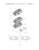 INTERVERTEBRAL MEDICAL IMPLANT diagram and image